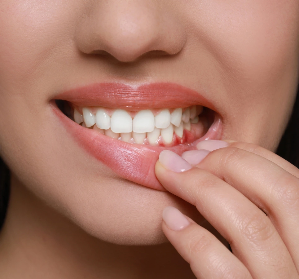 Periodontal Therapy Tulsa