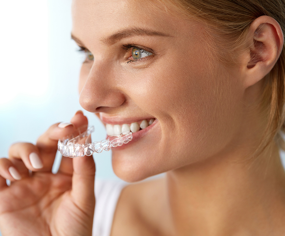Invisalign treatment